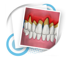 Periodontic Dental Service
